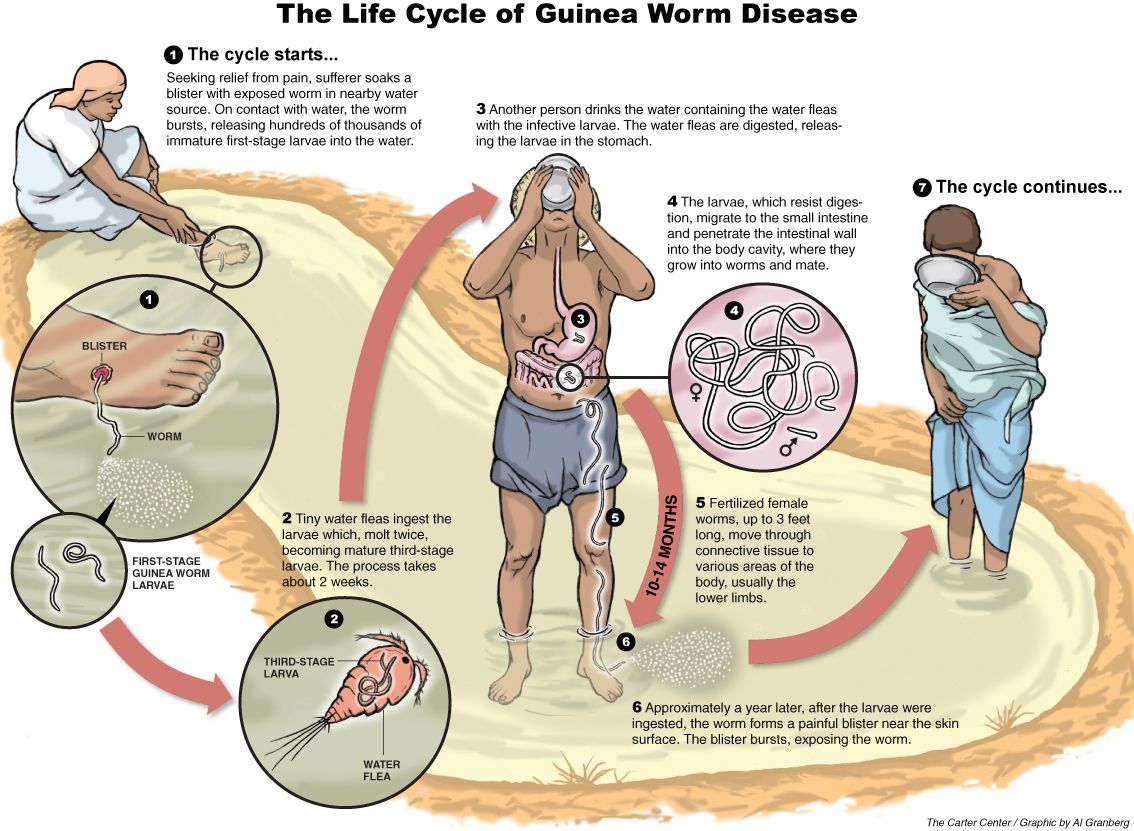 Jimmy carter guinea worm disease